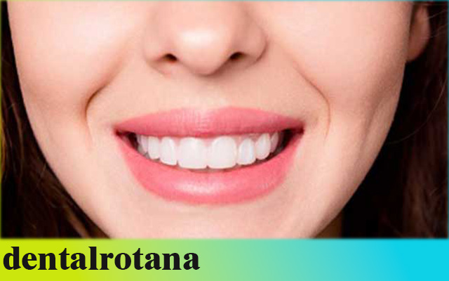 أفضل عيادة أسنان في إسطنبول