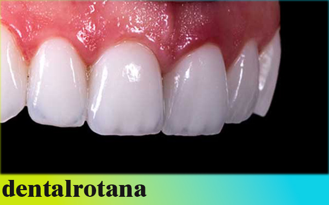 طب الأسنان في إسطنبول