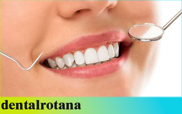 زراعة الأسنان بدون جراحة في تركيا