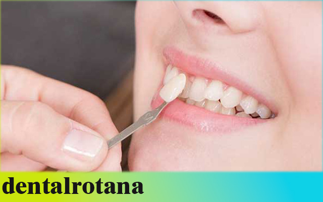 دليلك الشامل لأسعار زراعة الأسنان في تركيا