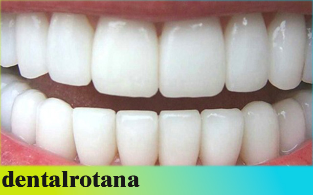 زراعة الأسنان الألمانية في تركيا