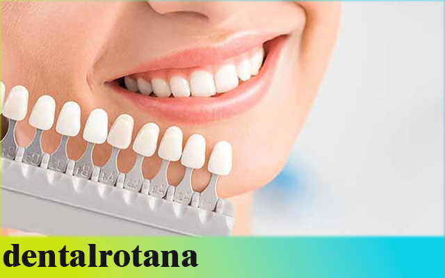 عيادات الأسنان في تركيا 2025