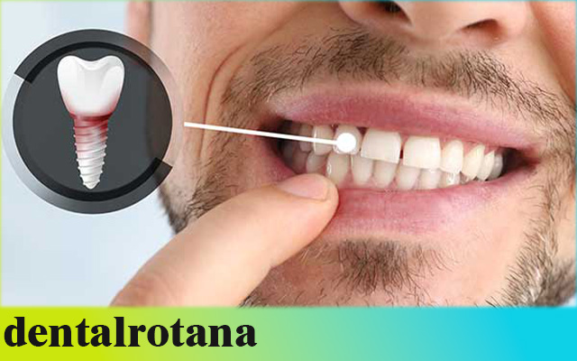 مركز طب الأسنان في تركيا: دليلك الشامل 2025 لاختيار الأفضل