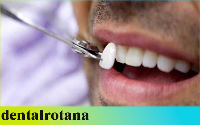 أفض طبيب أسنان في تركيا