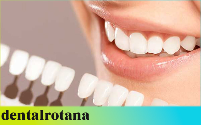 علاج الأسنان في تركيا 2025