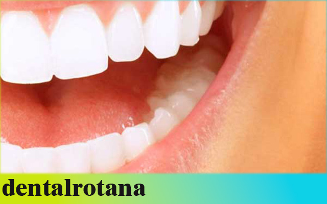 تكلفة علاج الأسنان في تركيا