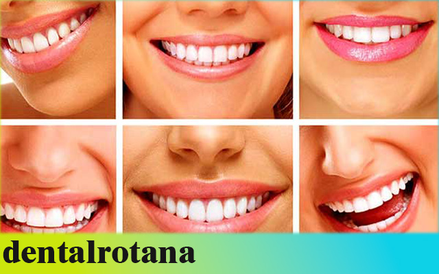 أسعار طب الأسنان في تركيا