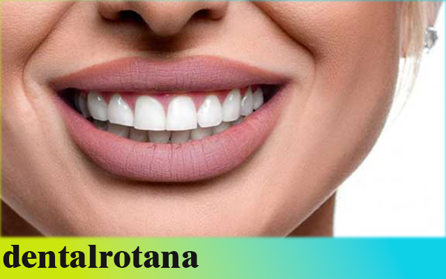 زراعة الأسنان السويسرية في تركيا